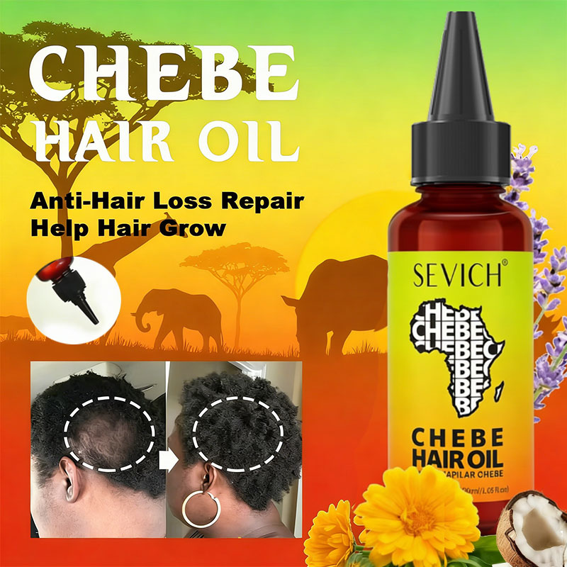 Beard Oil Growth - น้ำมันเชเบะเร่งผมยาว น้ำมันเชเบะจากแอฟริกา สำหรับผมร่วงจากภาวะแทรกชั่น อลโอเปเซีย บำรุงและซ่อมแซมเส้นผมที่เสียหาย ป้องกันผมร่วง