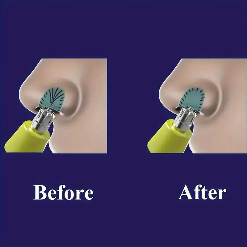 ใบมีดเปลี่ยนสำหรับเครื่องโกนหน - Electric Shaver Rotary บทวิจารณ์และราคา