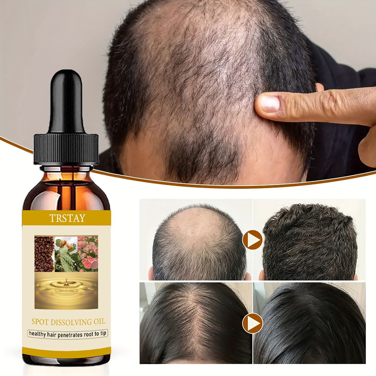 50ML Beard Growth Oil Anti Alo - Beard Oil Growth บทวิจารณ์และราคา