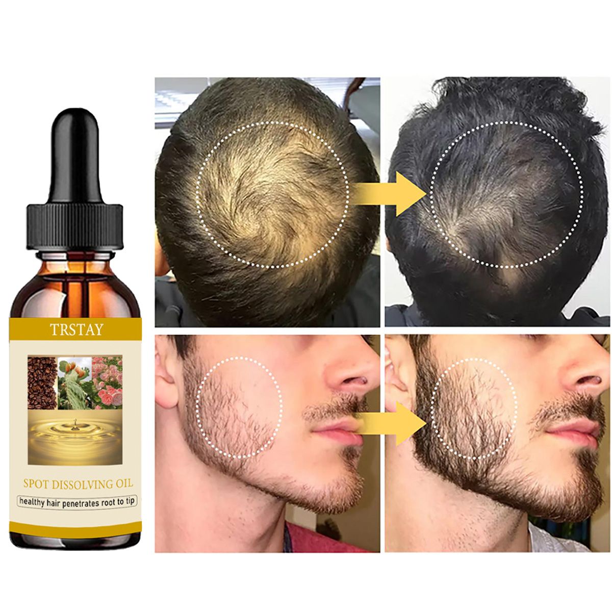 50ML Beard Growth Oil Anti Alo - Beard Oil Growth บทวิจารณ์และราคา