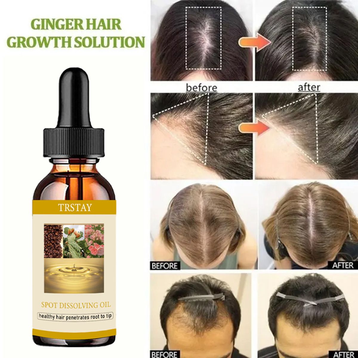 50ML Beard Growth Oil Anti Alo - Beard Oil Growth บทวิจารณ์และราคา