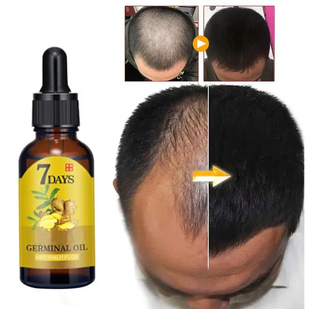 Hair Growth Ginger Fast Growin - Beard Oil Growth บทวิจารณ์และราคา