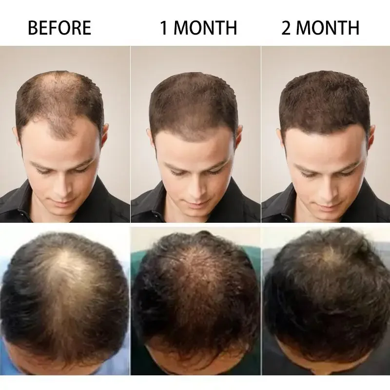 Hair Growth Ginger Fast Growin - Beard Oil Growth บทวิจารณ์และราคา