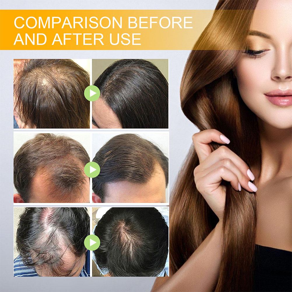 5/3/1pcs Biotin Fast Hair Grow - Beard Oil Growth บทวิจารณ์และราคา